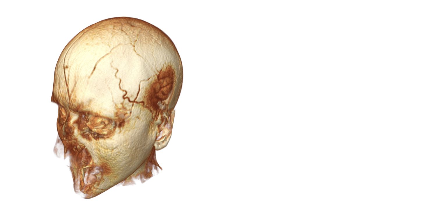 Three-dimensional MRI reconstruction on a white background