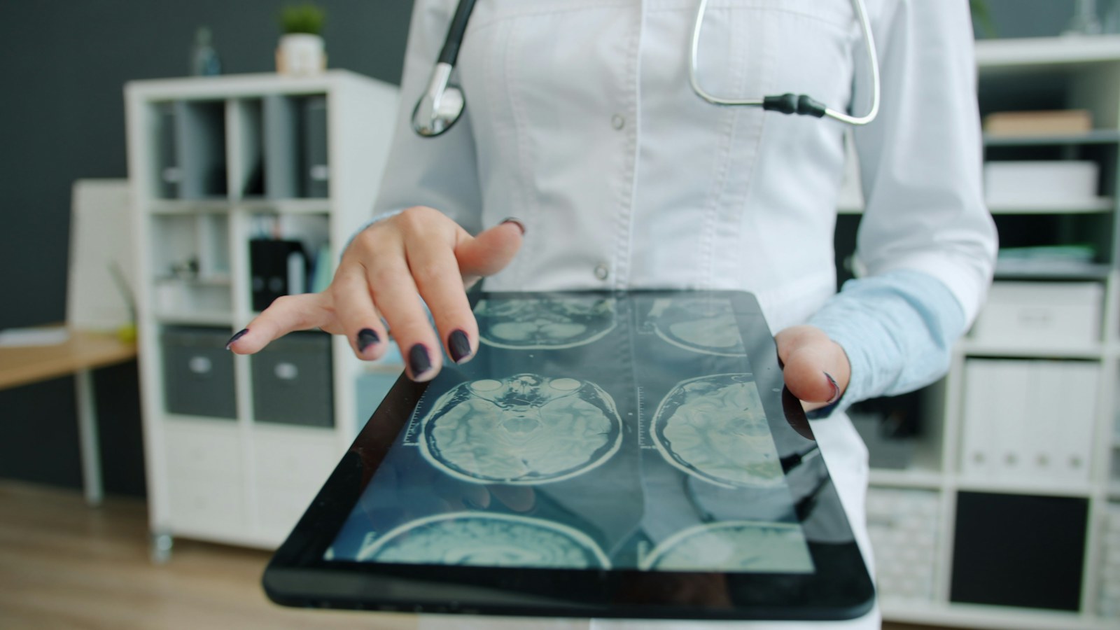 Illustrative photograph of a clinician reviewing brain MRI images on a tablet